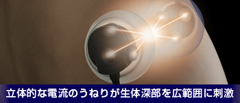 es500